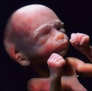 Bebé de 24 semanas de gestación. Foto tomada de Facebook Asociación Médicos por la Vida
